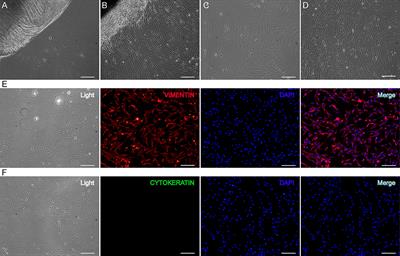 Transcriptional Feedback Loops in the Caprine Circadian Clock System